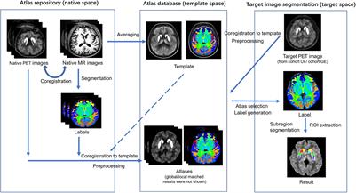 A Multi-Atlas-Based [18F]9-Fluoropropyl-(+)-Dihydrotetrabenazine Positron Emission Tomography Image Segmentation Method for Parkinson’s Disease Quantification